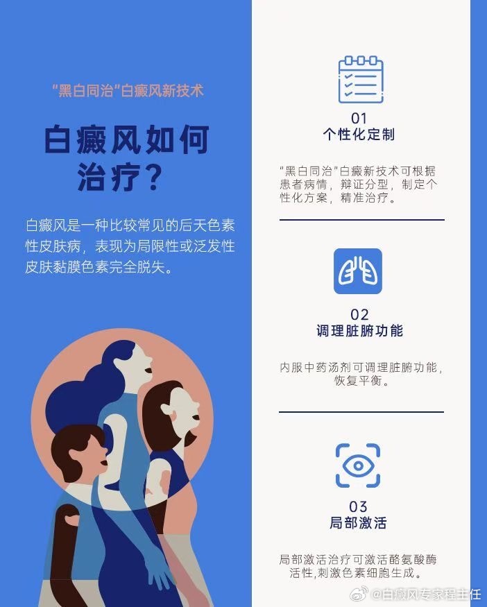 白癜风治疗最新研究进展揭秘，创新疗法引领治疗新方向